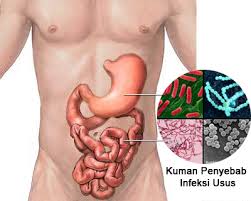 infeksi lambung dan usus